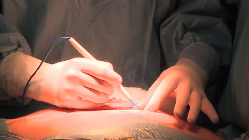 Organtransplantation und Bluttransfusion
