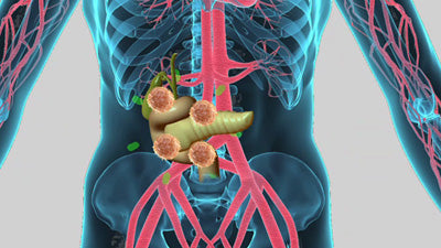 Autoimmunerkrankungen mit E-Learning